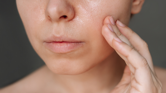 4 Tips to Manage Oily Skin