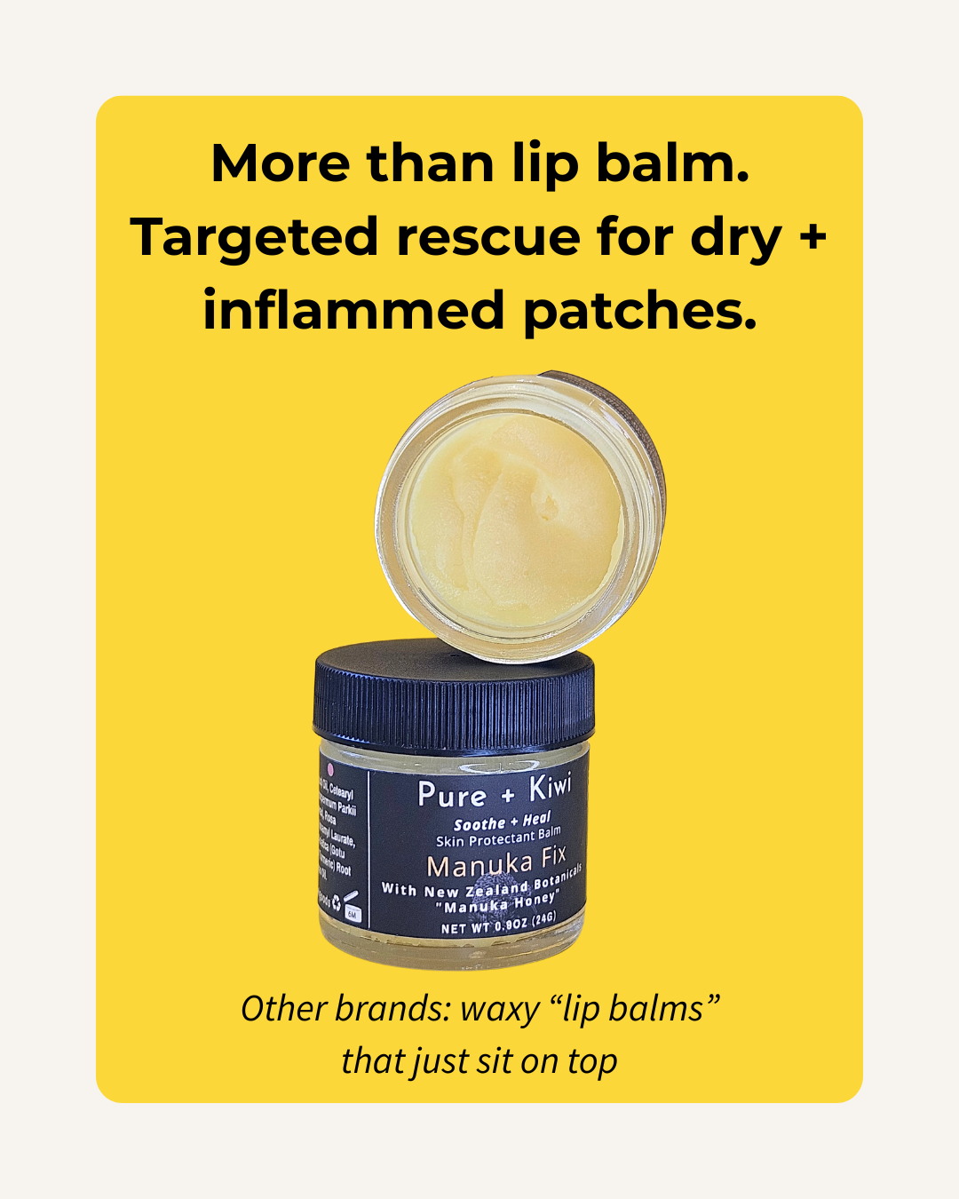MANUKA FIX - Barrier Rescue Balm for Sensitive, Eczema-Prone Skin