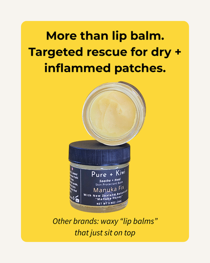 MANUKA FIX - Barrier Rescue Balm for Sensitive, Eczema-Prone Skin